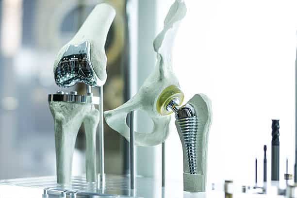 Moderne Knie- und Hüftprothesen, die von CAD-Ingenieuren hergestellt und im 3D-Druck hergestellt wurden